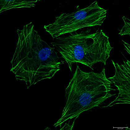 Image de microscopie à fluorescence d'ostéoblastes
