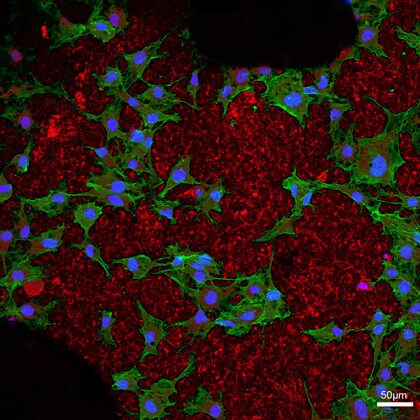 Image de microscopie à fluorescence d'ostéoblastes sur un biomatériau