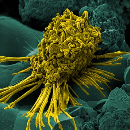 Image de microscopie électronique à balayage colorée d'un macrophage murin